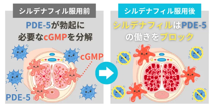 シルデナフィル